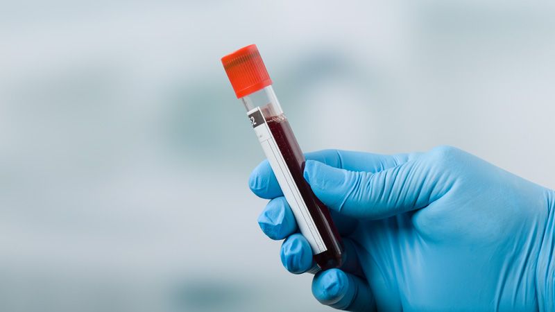 krew przeznaczona do badania znajdująca się w próbówce