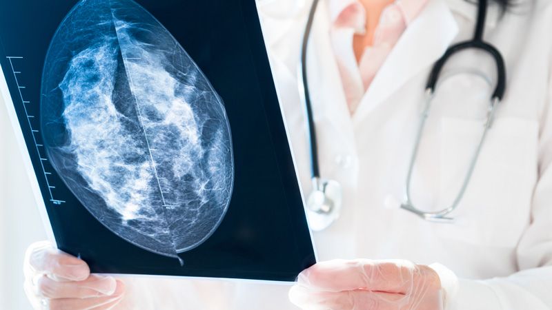 mammografia - badanie obrazowe 