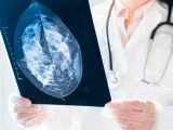 obraz piersi w badaniu mammograficznym