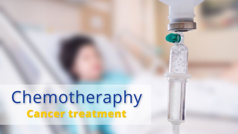 chemioterapia - zdjęcie poglądowe